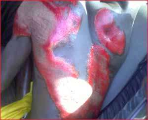 Atiwa, Akwatia – Danger Signs Ahead For 2012