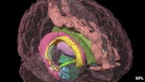 Scan of the brain showing amygdala in light blue
