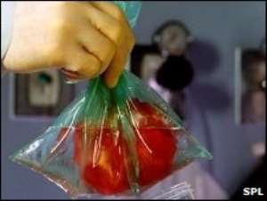 Donor organs are in short supply