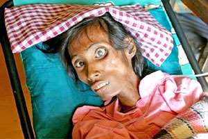 Herbal medicine and HIV/AIDS related skin diseases