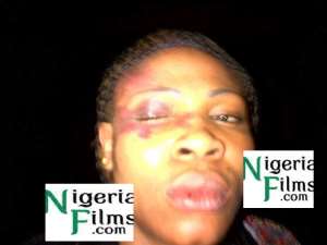 PICTURE: K-Solo Physically Assaults Wife