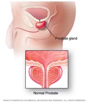 My Experience with Prostate Cancer: A Disease Every Man Needs to Know About