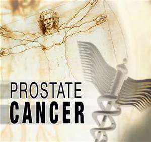 Prostate Cancer Is A Verb In Black Men And A Noun In White Men!