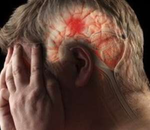 Many young people are now dying of stroke - report