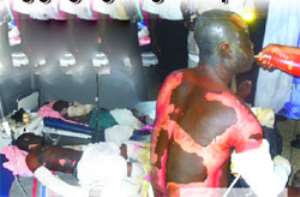 Two of the victims of last Monday's Ashaiman gas explosion at the Tema General Hospital (TGH) (left), Mr. Omane, anotrher of the Ashaiman gas explosion incident on admission at the Tema General Hospital (TGH)(right)