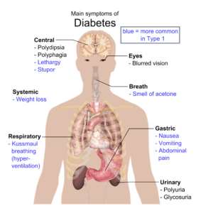 What is Diabetes and what causes Diabetes?