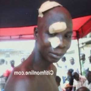 An avid NPP supporter, who sustained wounds during the attack on Wednesday