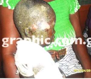 the improvised explosive device killed one and injures four children
