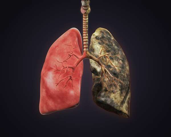 Risk of lung cancer among passive smokers