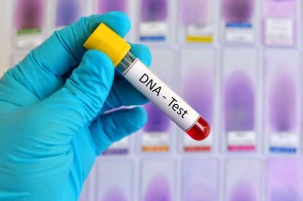 DNA testing, lest we forget
