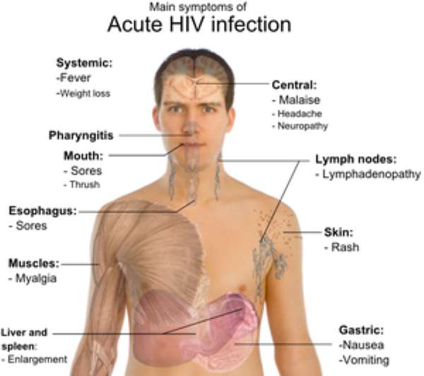 Oh To be Born Free - Without the Human Immunodeficiency Virus