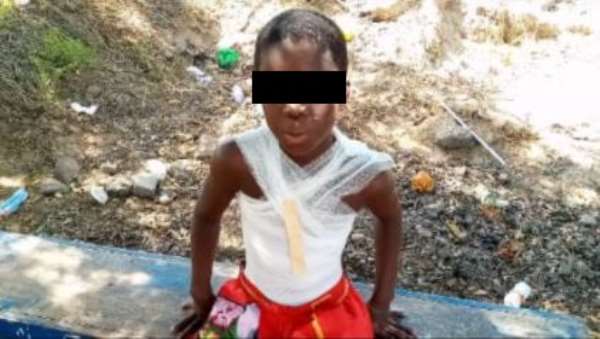 Wee smoker vowed to kill me – 10-year-ol boy who was set ablaze reveals