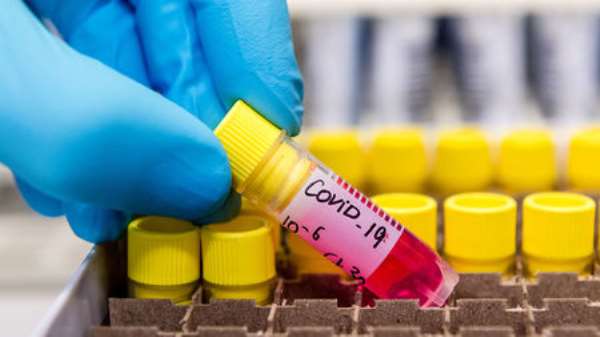 COVID-19: Cases Hit 1,550 With 271 More Cases