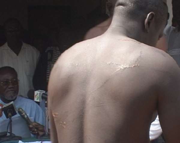 Victim of Police Brutality?