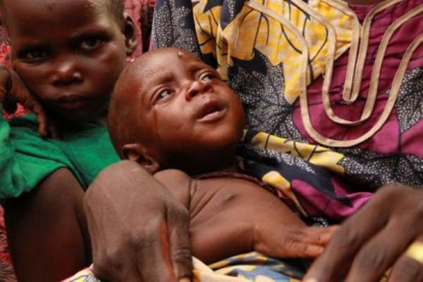 Poverty has denied a mother to take proper medical care for her child