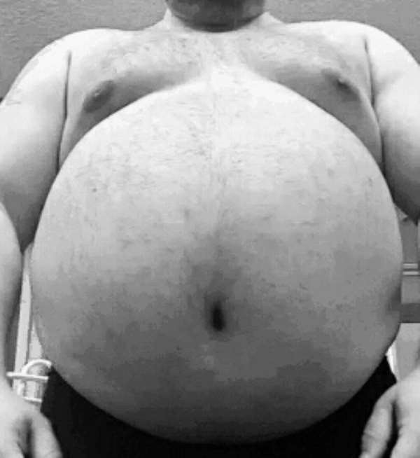 Insulin Resistance - Cause of Most Diseases And Most Deaths In Modern Times!