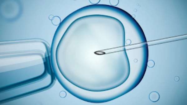 Everything you need to know about IVF