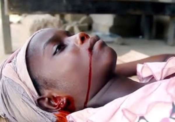 Hemorrhagic Fever (Ebola)