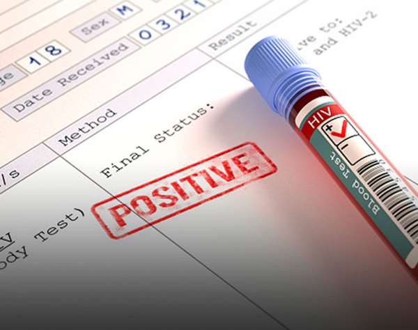 Over 142,000 Ghanaians Are HIV Positive But Don't Know – AIDS Commission