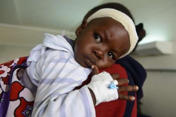 This picture taken on March 26, 2014 shows 18-month-old Satrin Osinya as he receives treatment at the Kenyatta National hospital in Nairobi. By Simon Mania (AFP/File)
