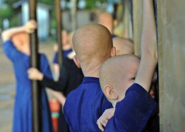Their limbs hacked off and babies and children abducted or killed, albinos in Tanzania live in fear of another horrific spate of attacks against them ahead of elections in October. By Tony Karumba (AFP/File)