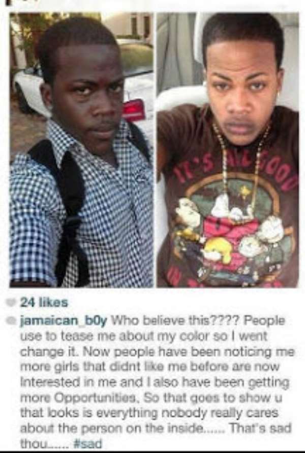 From Very Black To White And Defends His Bleaching