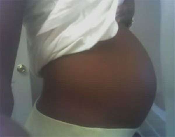 Teenage Pregnancy RiseS In BA