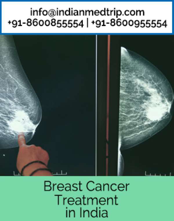 Choose A Best Oncologist For Breast Cancer Surgery In India With