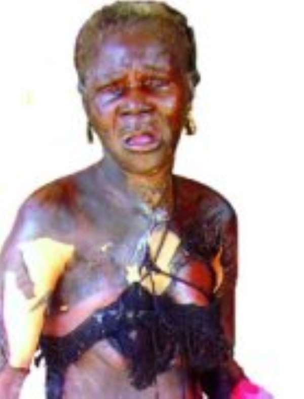Madam Ama Hemmah after her ordeal