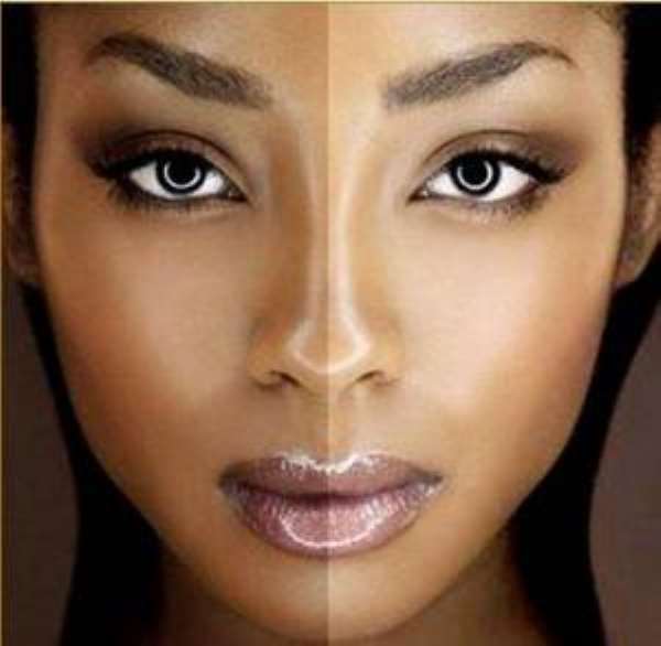 Skin bleaching, beauty option?