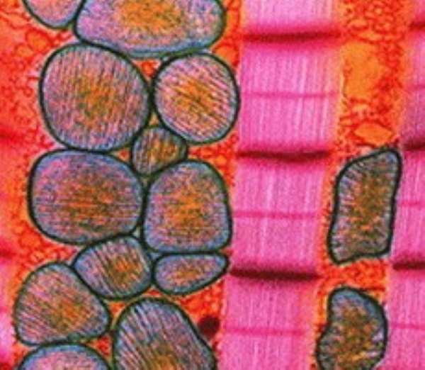 Tests to predict heart disease help men, not women