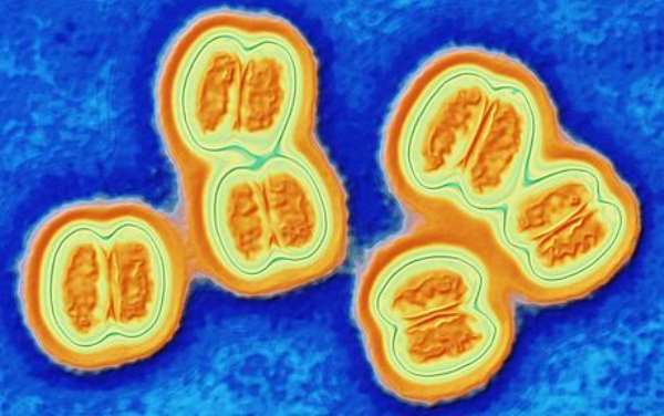 Democratic Republic of the Congo declares meningitis outbreak in north-eastern province