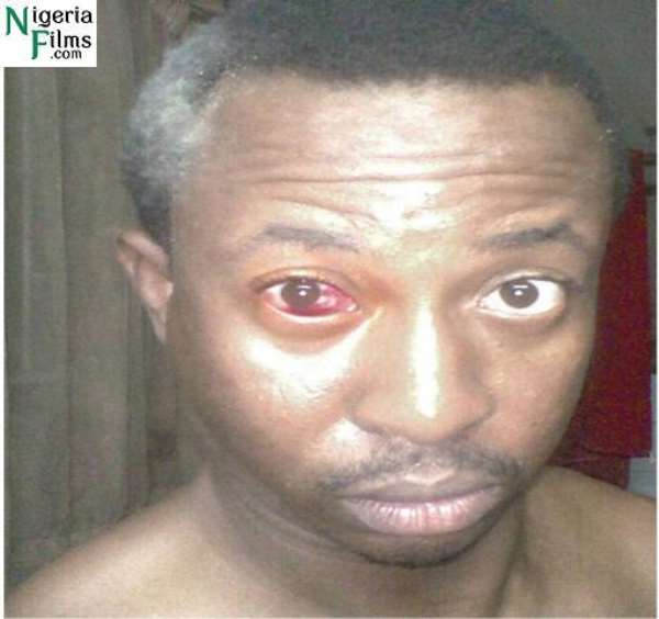 Policemen beat D’Lectura black and blue...•This is injustice -D’ Lectura •He was not beaten -Police PRO