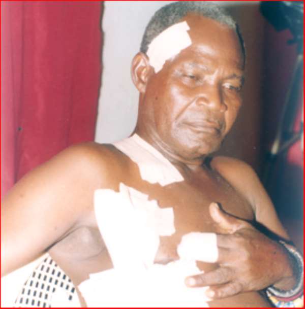 Bullet ridden! Baffour Kwadwo Abbam