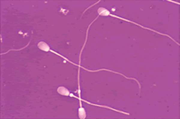 Semen 'may fuel cervical cancer'