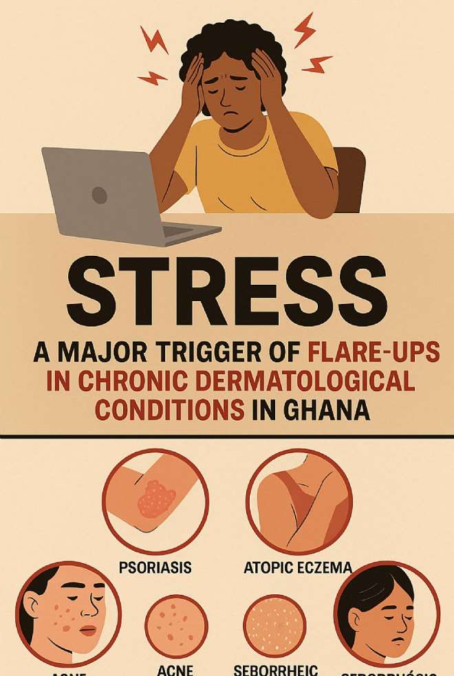 7142025104215-txobrfdq5l-stress-a-major-trigger