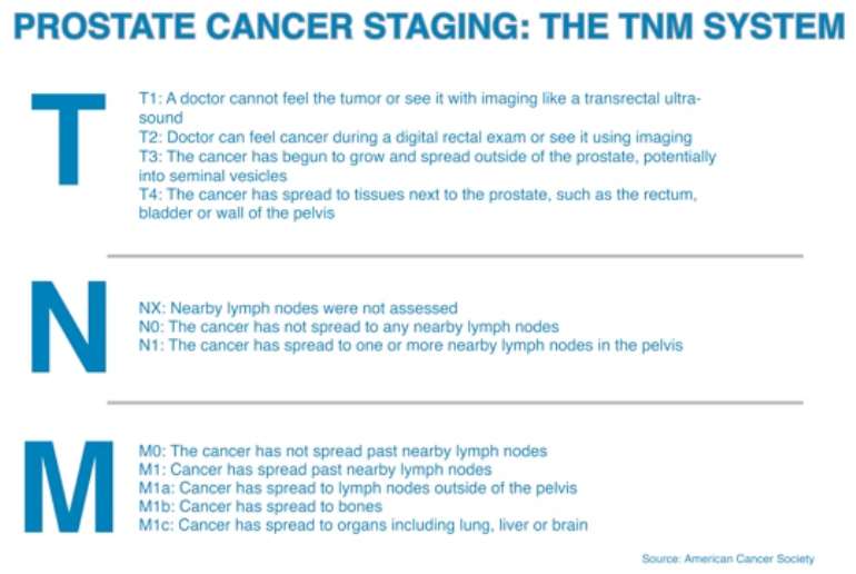 Prostate cancer stages