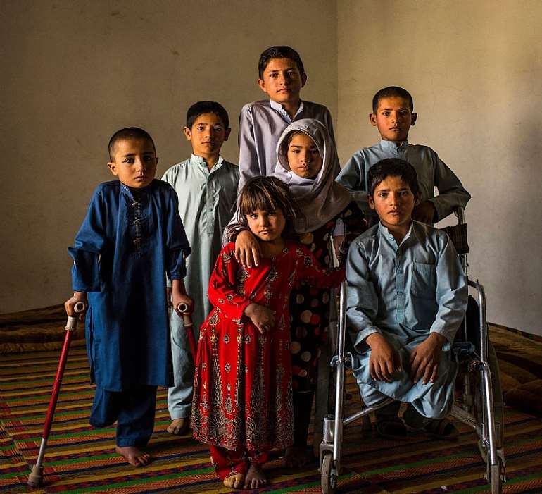 <em>Seven Afghan children from a village in the Surkh Rod district who were seriously injured in the explosion of an unexploded bomb</em>