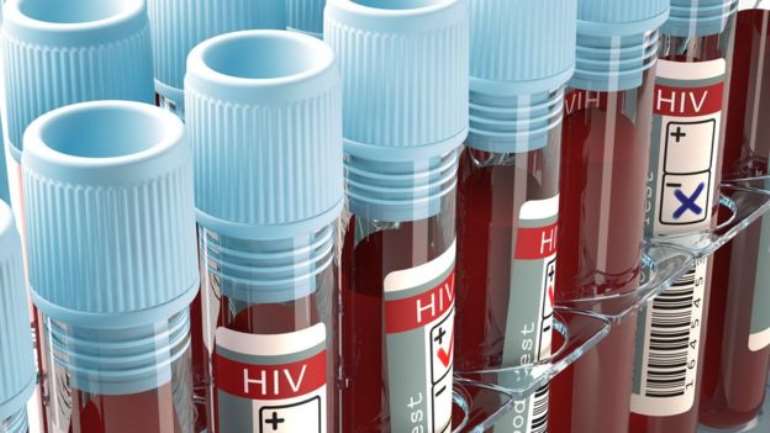 1242016113709  90892372 f0121503blood samples for hiv tests illustrationspl