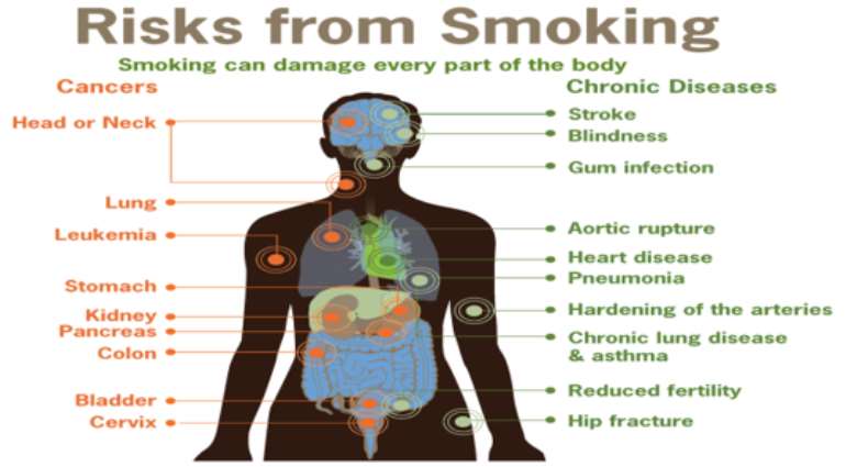 Smoking, Why Quit And How To Quit