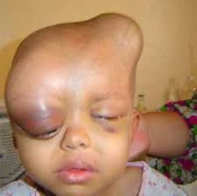73201852228 deformity