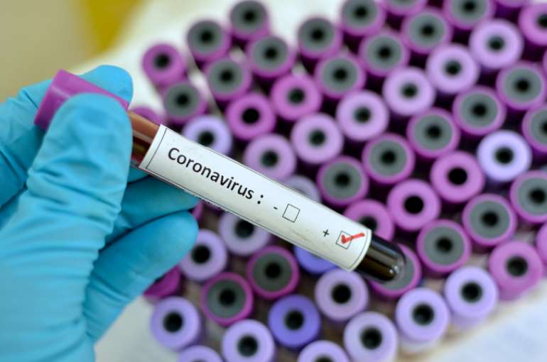 9142020110606-i4ep276gfb-new-coronavirus