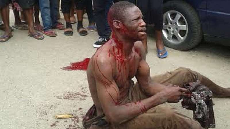 8. AN ASSAULTED CRIME SUSPECT BEGGING FOR MERCY