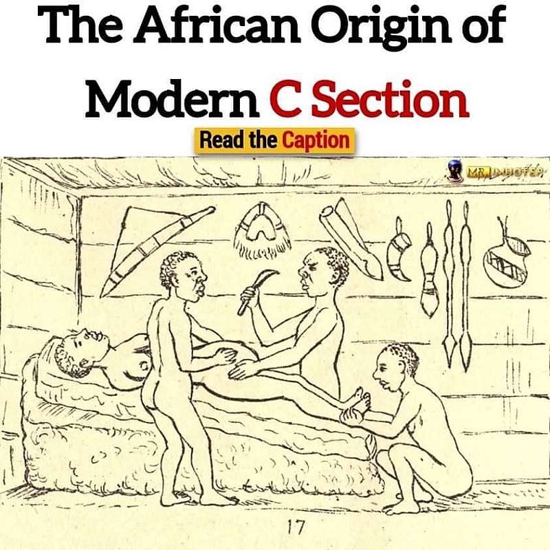 922202342528-swnyqdcp53-c-section