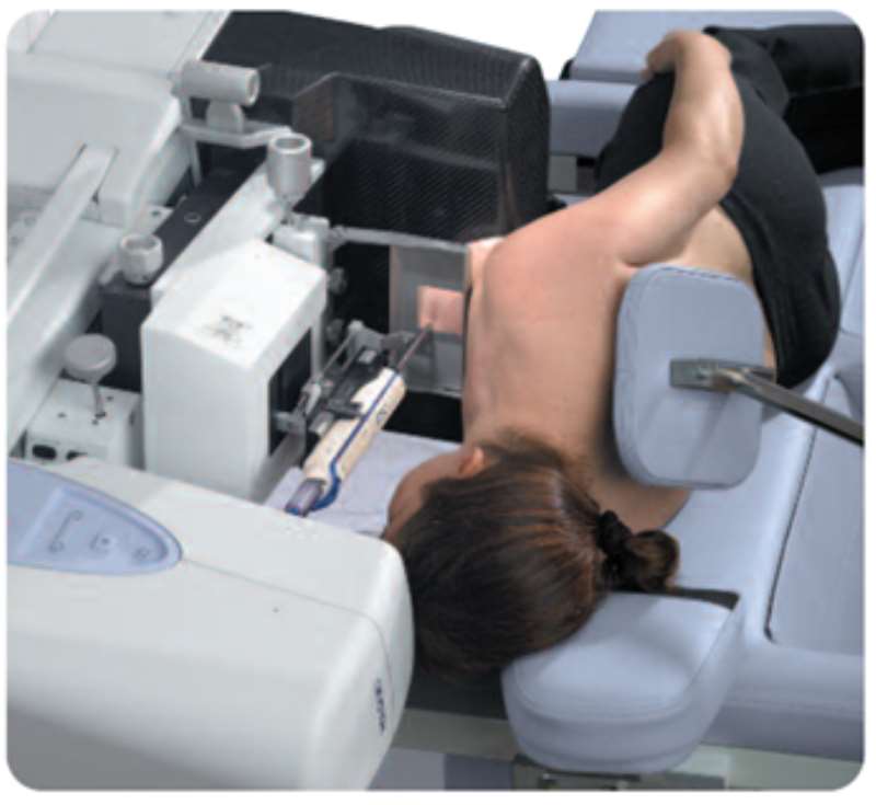 AMULET MAMOGRAPHY MACHINES-7