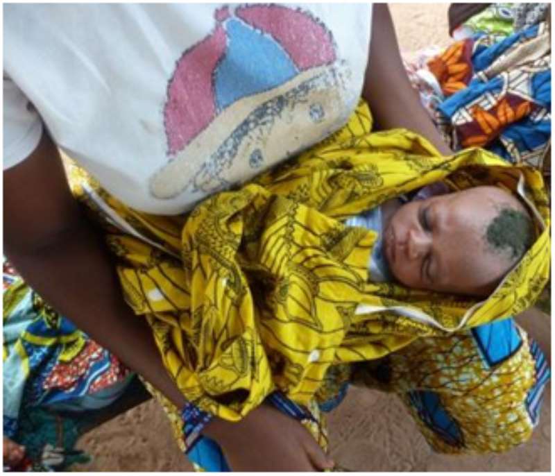 Cultural Barriers Such As Shaving Of Newborns Expose Them To Risks