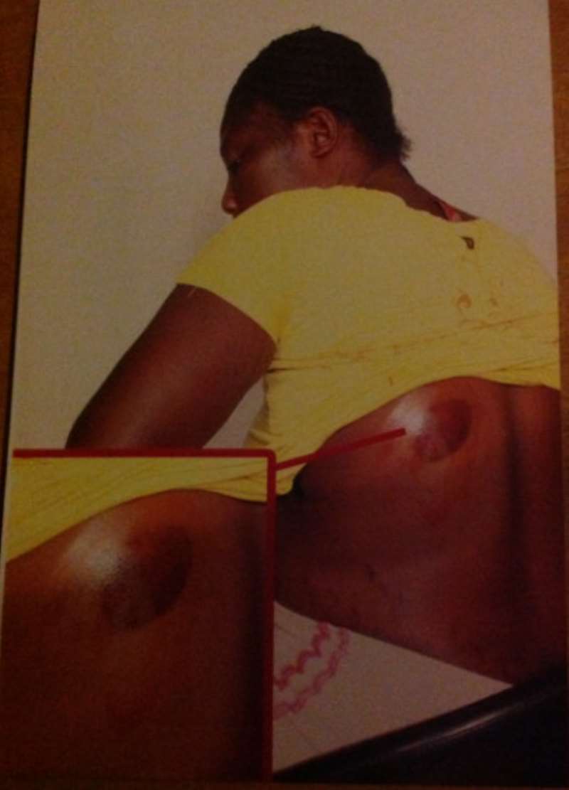 OBAA YAA, SHOWING HER WOUNDS