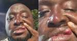 Okaikwei Central Vice Chairman allegedly assaulted in NPP Polling station elections