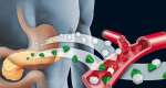 The Silent Problem Before Diabetes