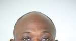 An Open Letter to Hon. James Agalga: Ghana Needs a Results-Oriented Majority Leader